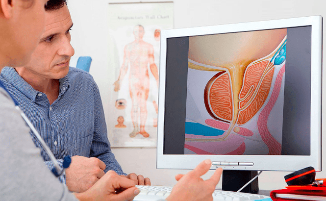 Diagnos vum Prostatitis