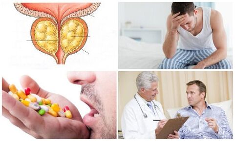 Prostatitis bei Männer